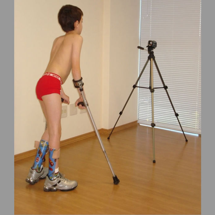 Análise visual da marcha