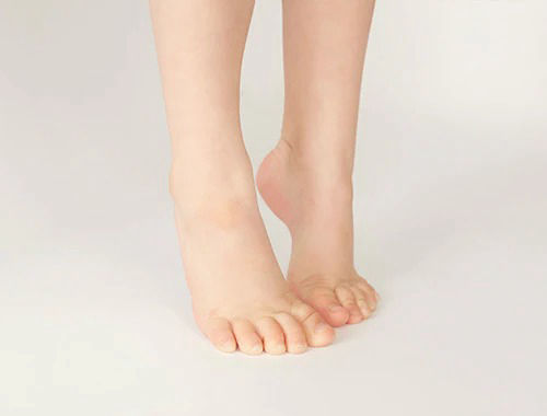 Marcha Equino Idiopática