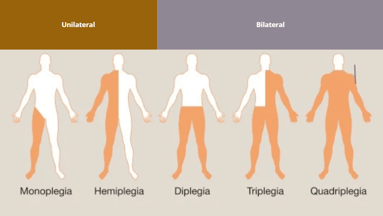 Paralisia cerebral - TOPOGRÁFICA
